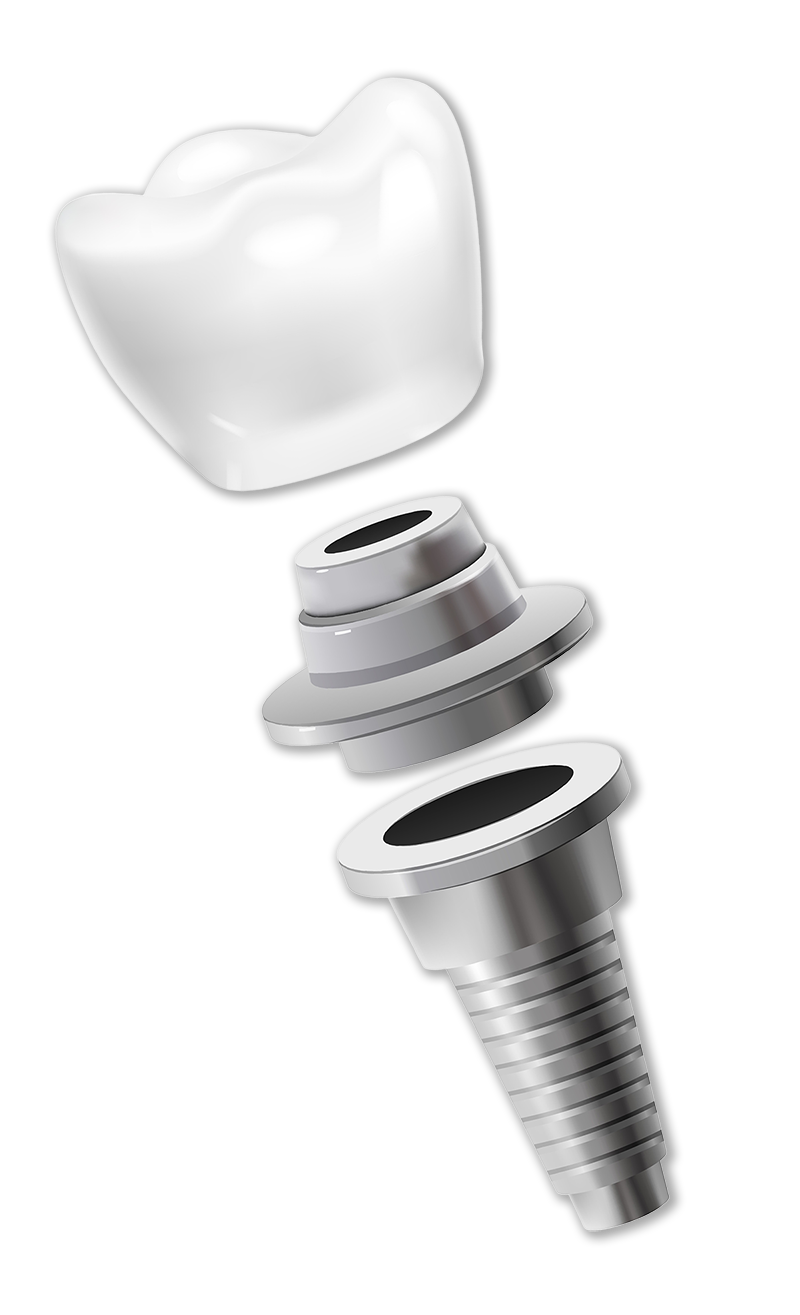 کلینیک دندانپزشکی تی دنتا|دکتر علیرضا تسلیمی و دکتر حدیث یگانه فرد 24 inverse