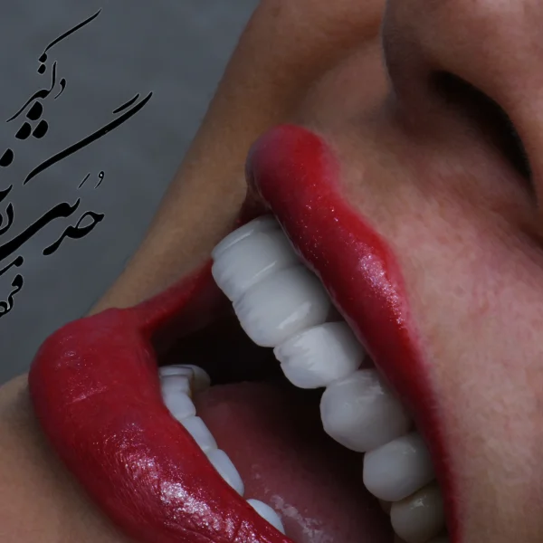 کلینیک دندانپزشکی تی دنتا|دکتر علیرضا تسلیمی و دکتر حدیث یگانه فرد 24 دکتر حدیث یگانه فرد و دکتر علیرضا تسلیمی