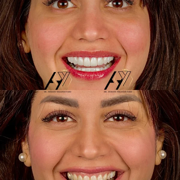 کلینیک دندانپزشکی تی دنتا|دکتر علیرضا تسلیمی و دکتر حدیث یگانه فرد 30 کلینیک تی دنتا|دکتر حدیث یگانه فرد