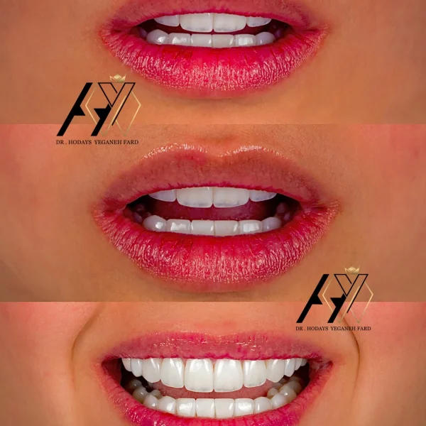 کلینیک دندانپزشکی تی دنتا|دکتر علیرضا تسلیمی و دکتر حدیث یگانه فرد 28 IMG 3320 11zon