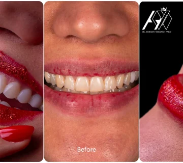 photo output 11zon 1