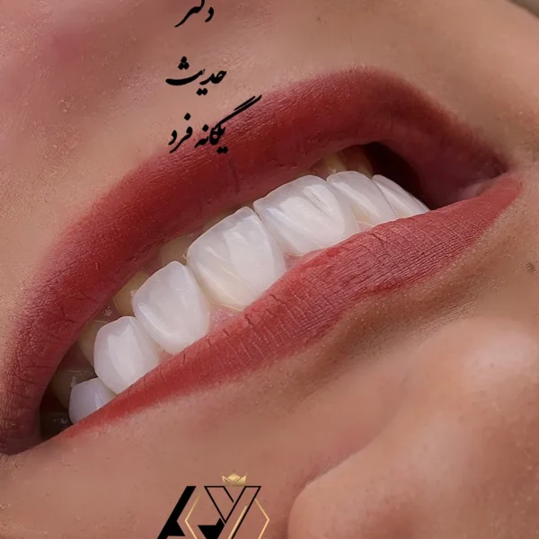 کلینیک دندانپزشکی تی دنتا|دکتر علیرضا تسلیمی و دکتر حدیث یگانه فرد 26 IMG 3321 11zon