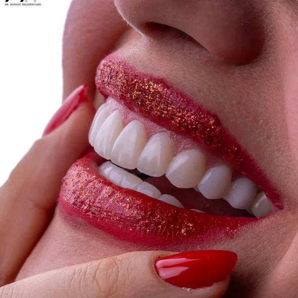 کلینیک دندانپزشکی تی دنتا|دکتر علیرضا تسلیمی و دکتر حدیث یگانه فرد 31 IMG 3386 11zon 1