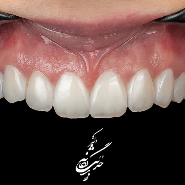 کلینیک دندانپزشکی تی دنتا|دکتر علیرضا تسلیمی و دکتر حدیث یگانه فرد 37 IMG 4731 11zon