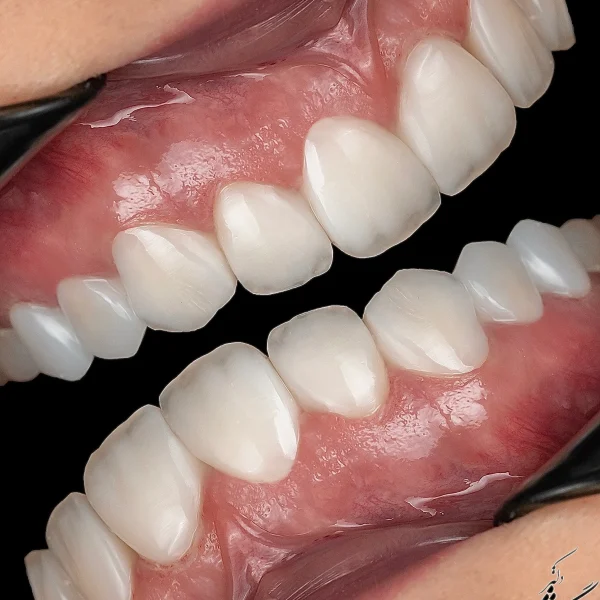 کلینیک دندانپزشکی تی دنتا|دکتر علیرضا تسلیمی و دکتر حدیث یگانه فرد 36 IMG 4735 11zon