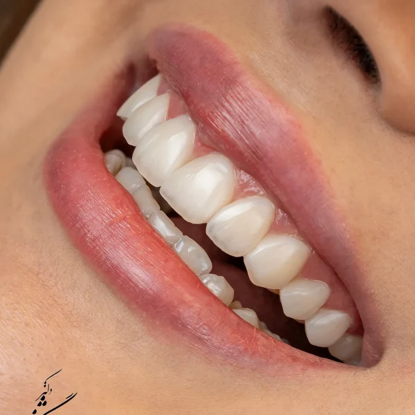 کلینیک دندانپزشکی تی دنتا|دکتر علیرضا تسلیمی و دکتر حدیث یگانه فرد 20 IMG 4737 11zon