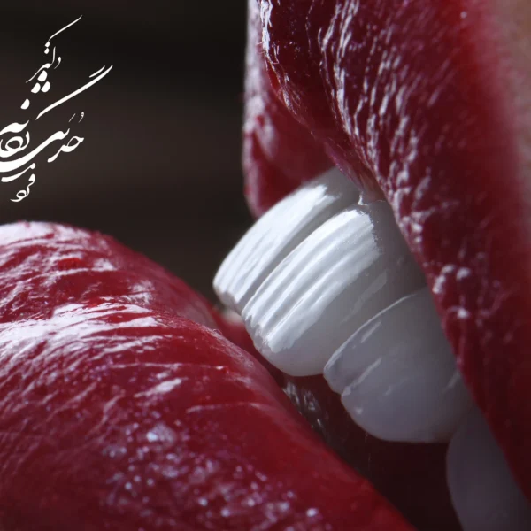 کلینیک دندانپزشکی تی دنتا|دکتر علیرضا تسلیمی و دکتر حدیث یگانه فرد 34 راهنمای جامع کامپوزیت دندان: مزایا، معایب، مراحل انجام و مراقبتها با معرفی پزشکان متخصص TYDENTA برای لبخندی زیبا و طبیعی در تهران.