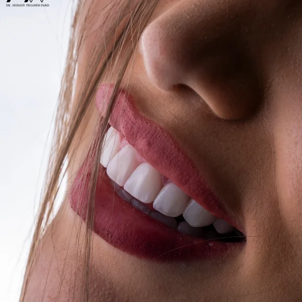 کلینیک دندانپزشکی تی دنتا|دکتر علیرضا تسلیمی و دکتر حدیث یگانه فرد 19 دکتر حدیث یگانه فرد| بهتربن کلینیک ایمپلنت در تهران