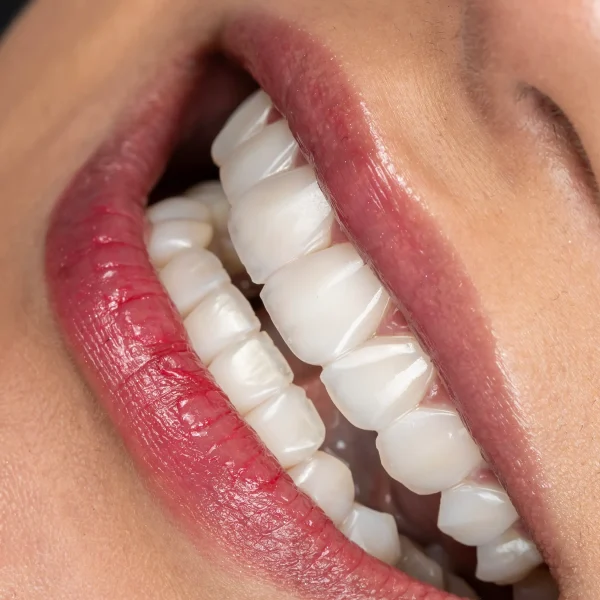 کلینیک دندانپزشکی تی دنتا|دکتر علیرضا تسلیمی و دکتر حدیث یگانه فرد 40 IMG 5698 11zon 1