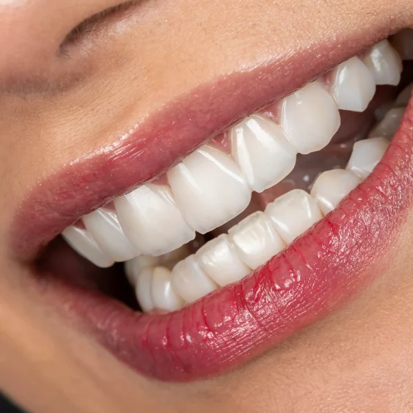 کلینیک دندانپزشکی تی دنتا|دکتر علیرضا تسلیمی و دکتر حدیث یگانه فرد 17 IMG 5698 11zon