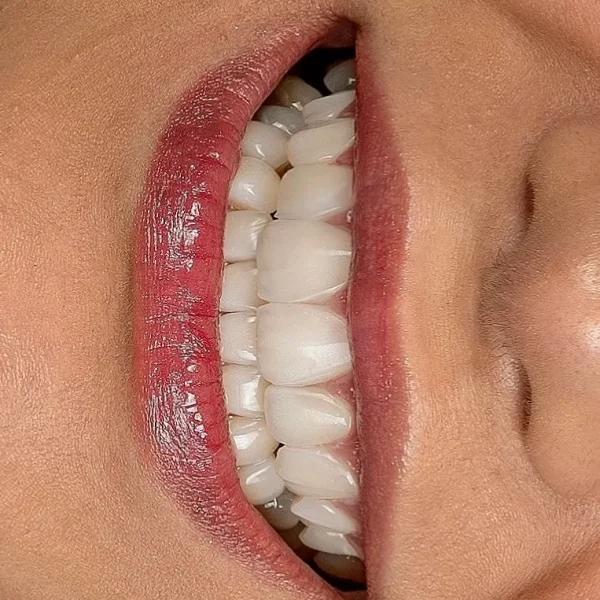 کلینیک دندانپزشکی تی دنتا|دکتر علیرضا تسلیمی و دکتر حدیث یگانه فرد 41 IMG 5699 11zon