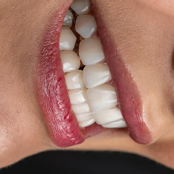 کلینیک دندانپزشکی تی دنتا|دکتر علیرضا تسلیمی و دکتر حدیث یگانه فرد 42 IMG 5702 11zon