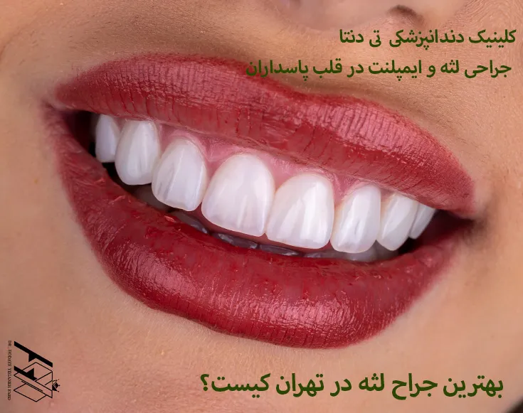 بهترین جراح لثه در تهران کیست؟ معرفی کامل متخصص بورد پریودانتیکس کلینیک تی دنتا