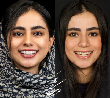 بهترین متخصص کامپوزیت دندان در پاسداران