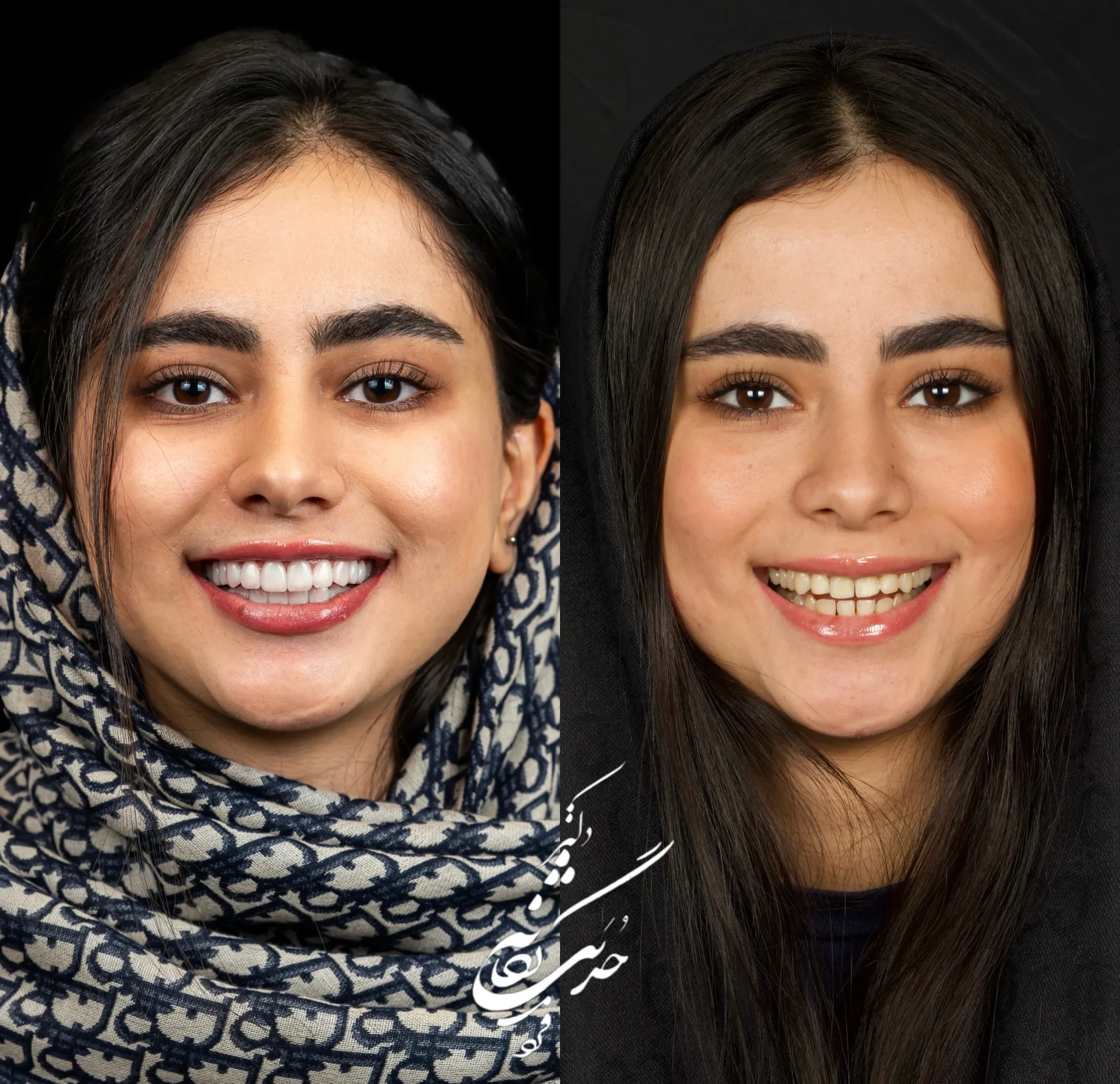 کلینیک دندانپزشکی تی دنتا|دکتر علیرضا تسلیمی و دکتر حدیث یگانه فرد 17 بهترین متخصص کامپوزیت دندان در پاسداران