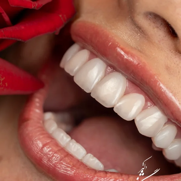 کلینیک دندانپزشکی تی دنتا|دکتر علیرضا تسلیمی و دکتر حدیث یگانه فرد 45 IMG 5991 11 11zon