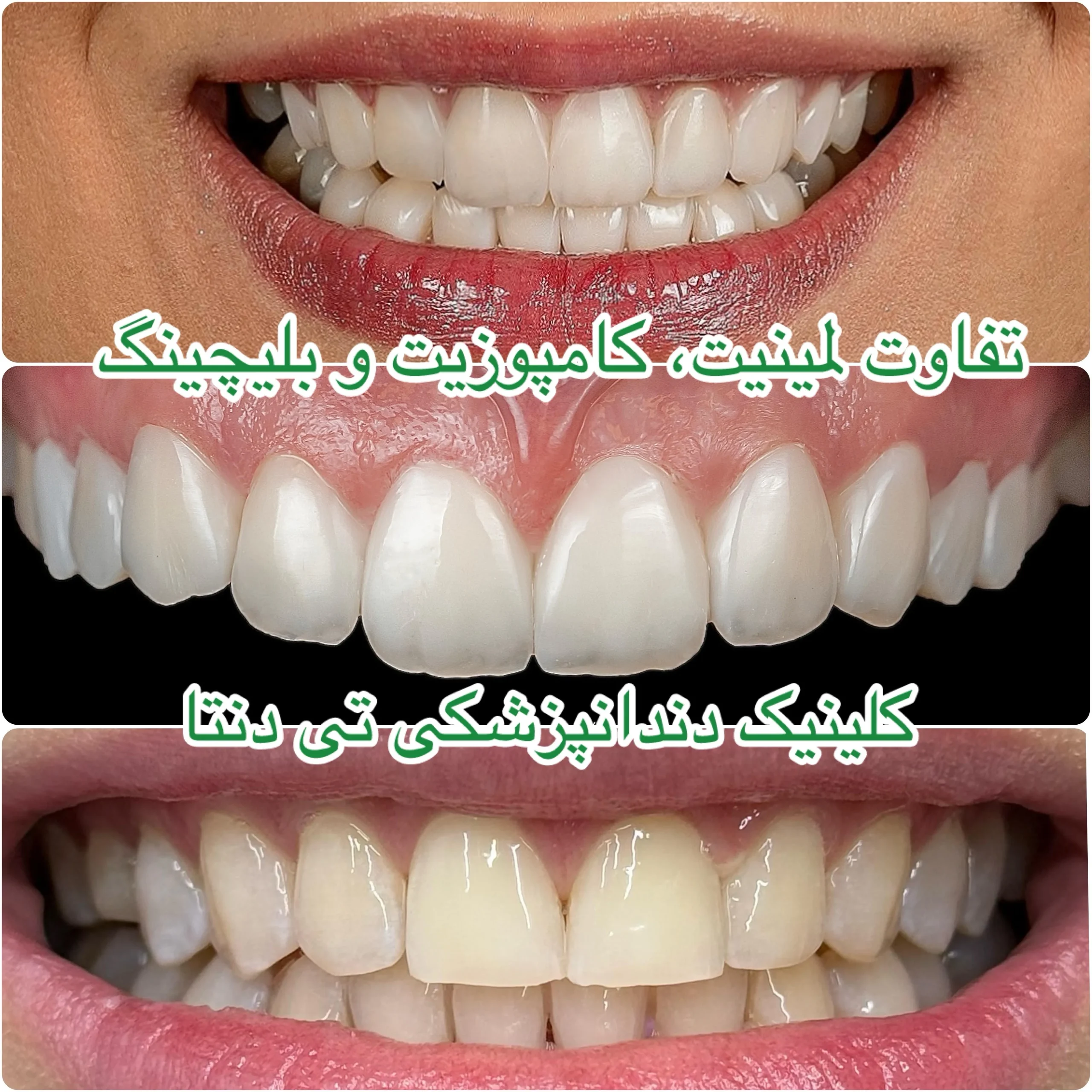 کلینیک دندانپزشکی تی دنتا|دکتر علیرضا تسلیمی و دکتر حدیث یگانه فرد 19 unnamed 2 11zon scaled