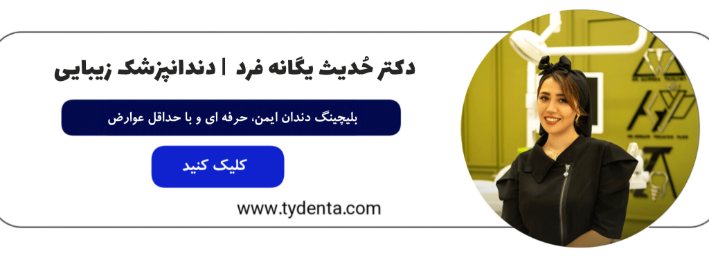 بلیچینگ دندان در کلینیک تی دنتا بدون عوارض و ایمن توسط دکتر حدیث یگانه فرد