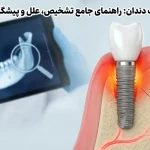 عوارض ایمپلنت دندان راهنمای جامع تشخیص، علل و پیشگیری از مشکلات| کلینیک دندانپزشکی تی دنتا