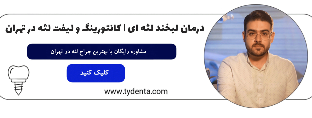لیفت لثه و درمان لبخند لثه ای در تهران پاسداران | کلینیک تی دنتا