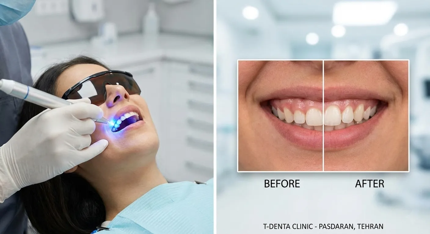 کلینیک دندانپزشکی تی دنتا|دکتر علیرضا تسلیمی و دکتر حدیث یگانه فرد 49 لیفت لثه در تهران - دکتر علیرضا تسلیمی و دکتر حدیث یگانه فرد