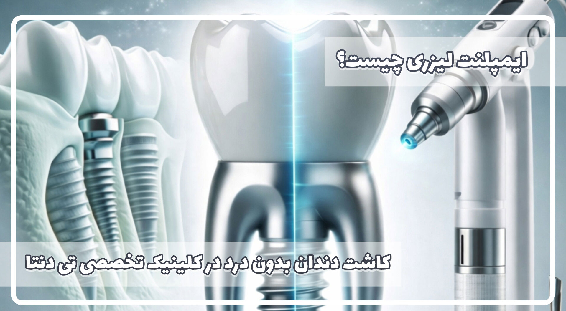 ایمپلنت لیزری چیست؟ ایمپلنت دندان بدون درد در کلینیک تخصصی تی دنتا 1 ایمپلنت-لیزری-چیست-ایمپلنت-دندان-با-لیزر