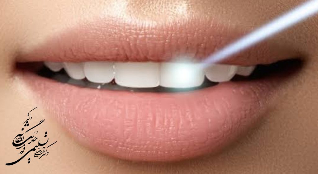 برتری ایمپلنت لیزر نسبت به سایر روشها