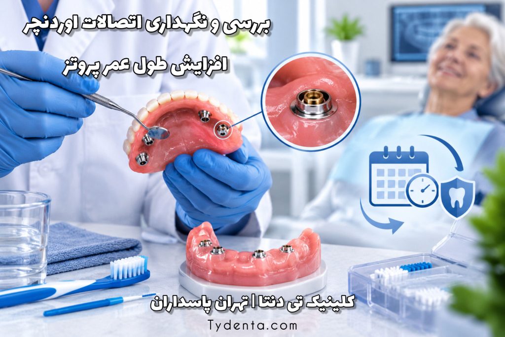 بررسی و نگهداری اتصالات اوردنچر برای افزایش طول عمر پروتز
