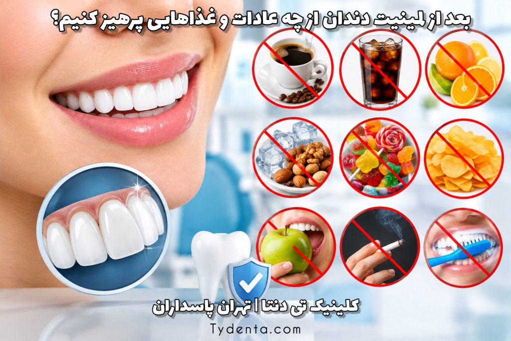 بعد از لمینیت دندان از چه غذاها و عادت‌هایی پرهیز کنیم؟