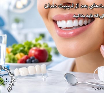 مراقبت های بعد از لمینیت دندان؛ چگونه ماندگاری لمینت را افزایش دهیم؟