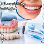 مراقبت‌های بعد از اوردنچر؛ از تمیز کردن اتصالات تا افزایش طول عمر پروتز