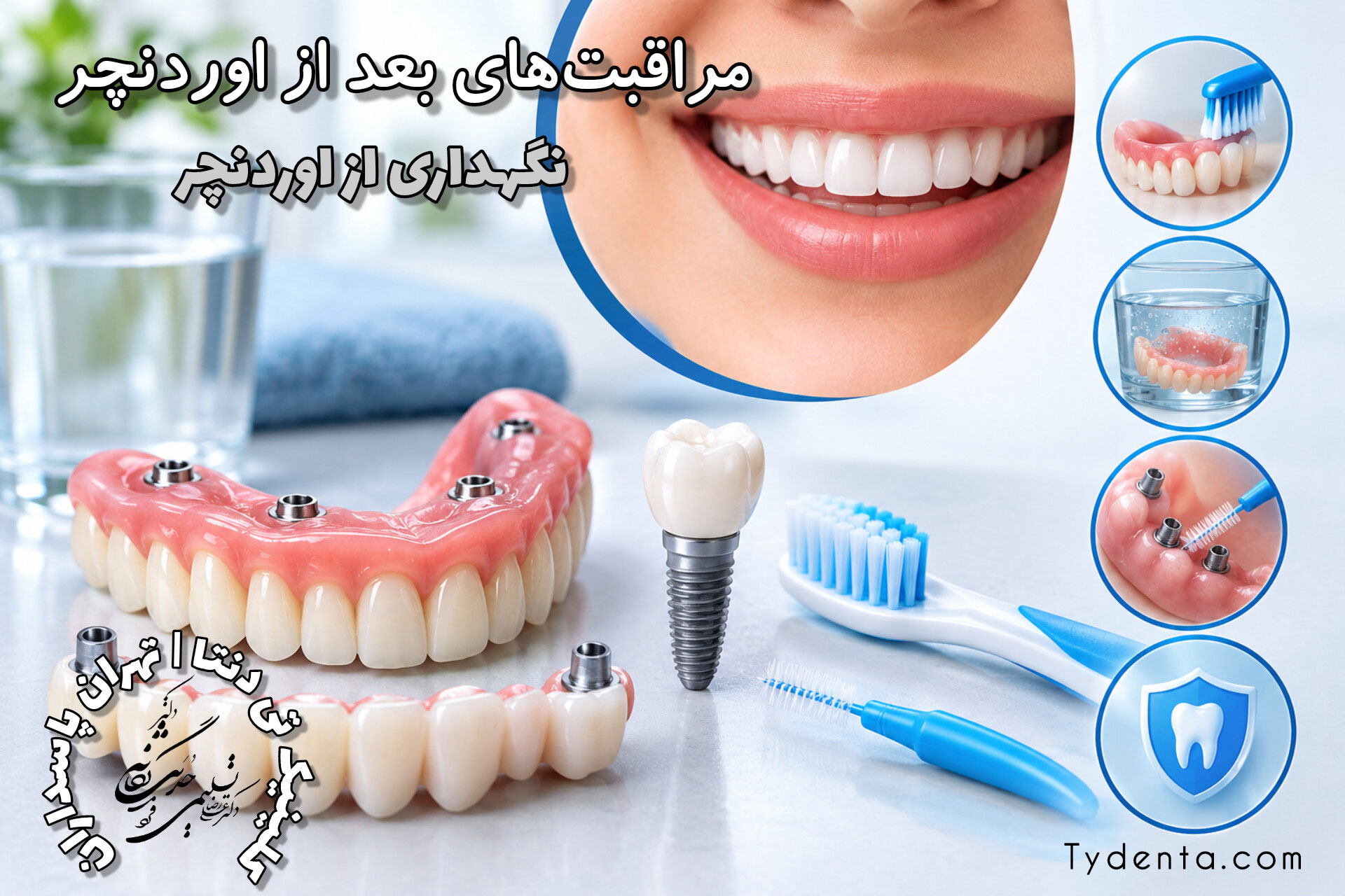 مراقبت‌های بعد از اوردنچر؛ از تمیز کردن اتصالات تا افزایش طول عمر پروتز