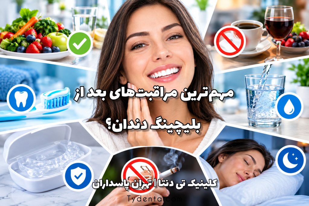 مهم‌ترین مراقبت های بعد از بلیچینگ دندان