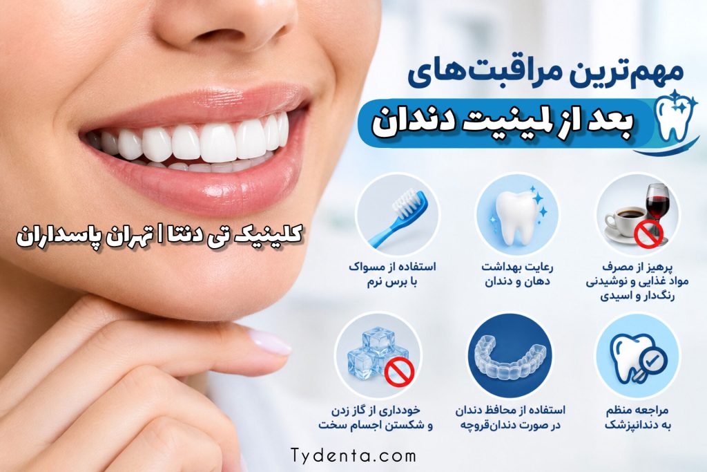 مهم‌ترین مراقبت های بعد از لمینیت دندان