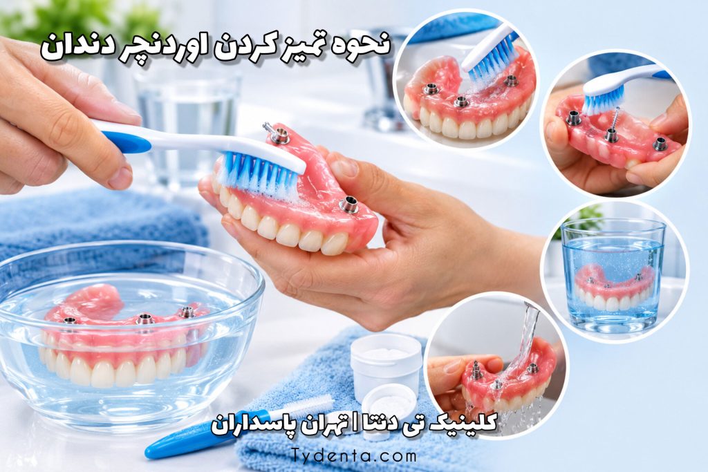 نحوه تمیز کردن اوردنچر دندان