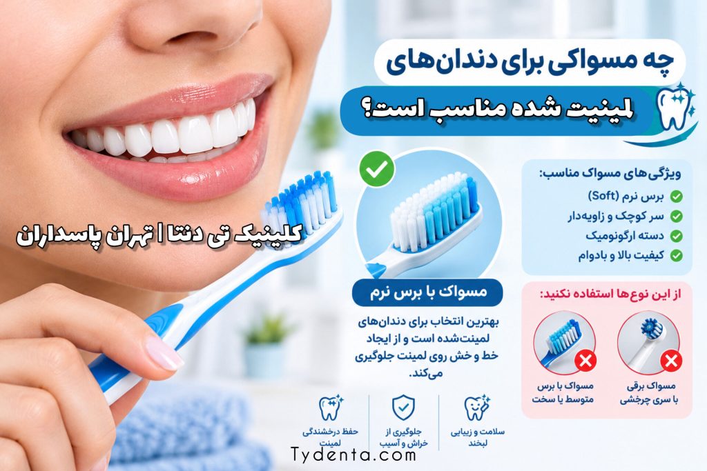 چه مسواکی برای دندان‌های لمینیت‌شده مناسب است؟