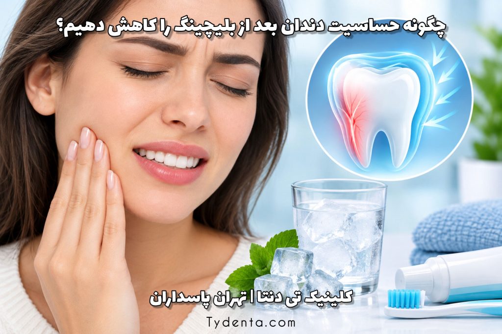 چگونه حساسیت دندان بعد از بلیچینگ را کاهش دهیم؟