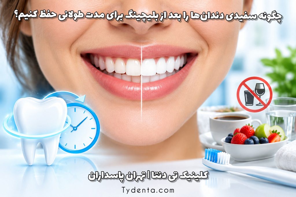 چگونه سفیدی دندان‌ها را بعد از بلیچینگ برای مدت طولانی حفظ کنیم؟